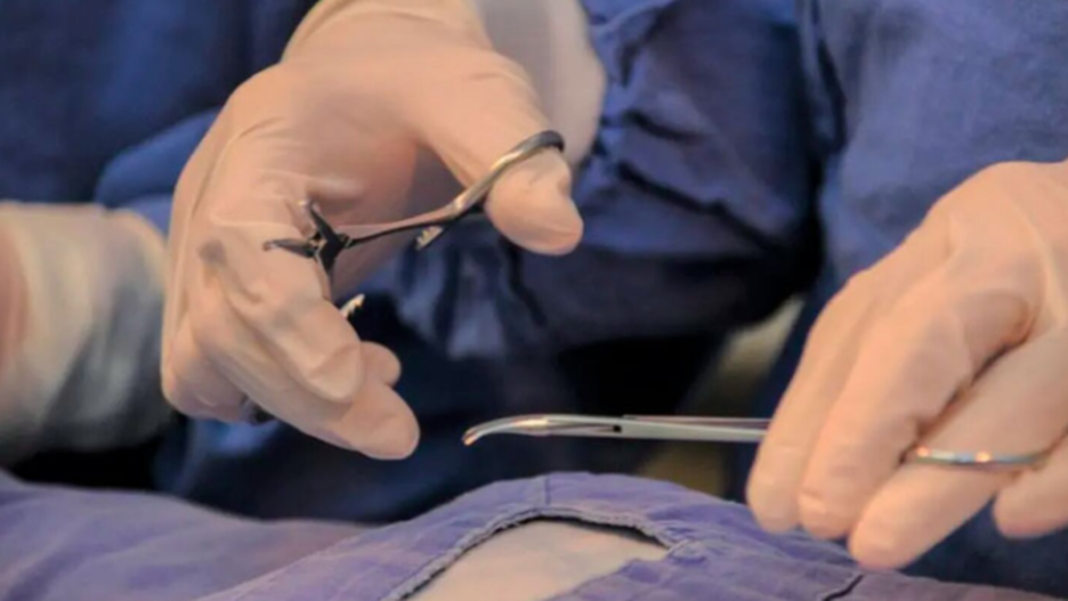 Médico urólogo explicando procedimiento de vasectomía