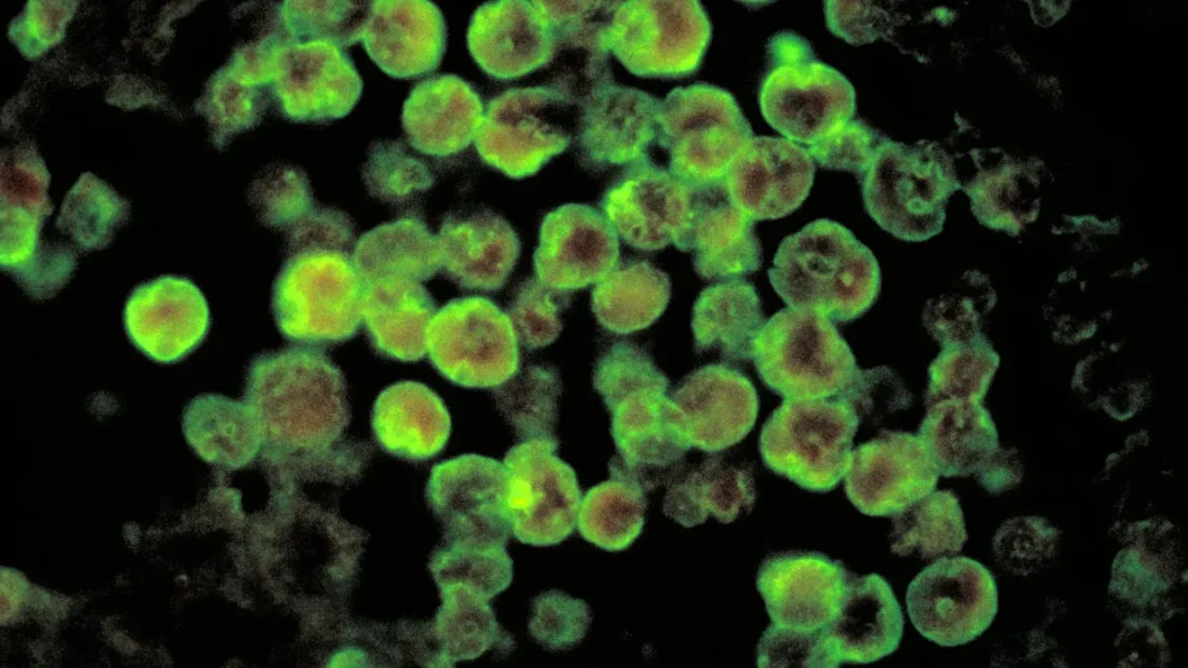 Comunicado del Colegio Médico de Catamarca sobre meningoencefalitis amebiana